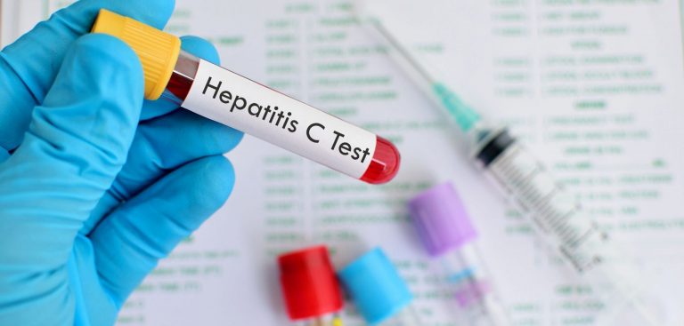 Tratamiento efectivo para la Hepatitis C