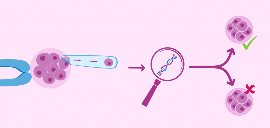 Preimplantation Genetic Diagnosis (PGD) – Medical Pharma News | Modern ...